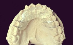 牙齿矫正导板图片能看出矫正效果吗？