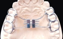 口腔正畸带环图片