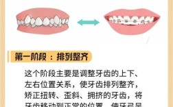 26岁矫正牙齿，整个过程一般需要多久？