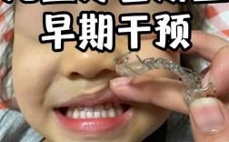 12岁是牙齿矫正的黄金时期吗？矫正效果如何？