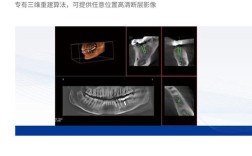 口腔科正畸CBCT拍摄的具体临床操作要求有哪些？