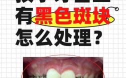 正畸牙齿有小黑点