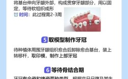 植牙是否人人适用？哪些情况需谨慎？