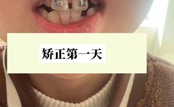 哈尔滨矫正牙齿去哪里好？专业靠谱的机构怎么选？