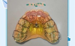 颌垫舌簧的正确使用方法是什么？具体操作步骤和注意事项有哪些？