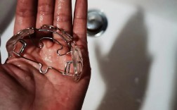 牙齿矫正后又反弹了