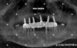 种牙拆线疼正常吗？疼多久能缓解？