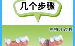 种植牙中灌牙这一步是怎么进行的？