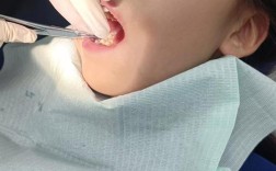 杭州口腔医院儿童正畸，孩子几岁开始矫正效果最佳？