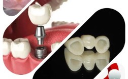 活动假牙如何稳固不掉？实用方法有哪些？