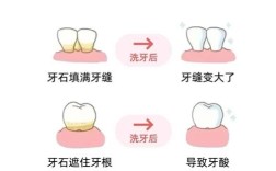 哪种牙漂白治疗方法最好？专家推荐最优安全方案