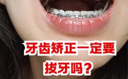 牙齿矫正能拔智齿吗？