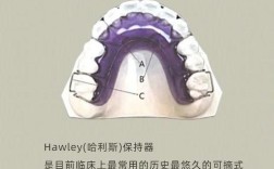 矫正牙齿后，保持器有哪些常见类型？