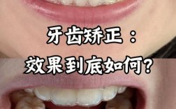 矫正牙齿磨牙的效果究竟如何？对牙齿矫正效果影响大吗？