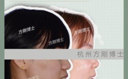 浙江口腔医院牙齿矫正