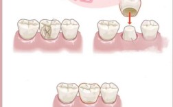 正畸时做冠修复会影响牙齿移动吗？