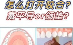 正畸戴颌垫吃东西，会有哪些影响？该怎么吃？