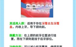 正畸牵引开窗是什么？详解其正畸治疗中的原理与作用