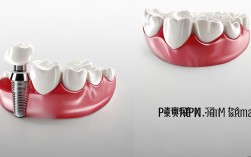 种植牙和烤瓷牙难选择？哪种修复方式更适合你？
