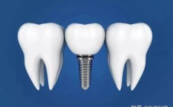 嘉兴种牙去哪儿好？靠谱医院怎么选？