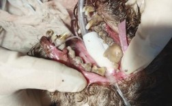 拜博种牙为何被指坑人？价格效果存疑？