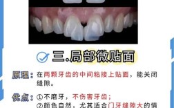 牙稀缝隙大可以种牙么