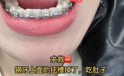 矫正牙齿后吃不了东西，是正常现象吗？怎么缓解？