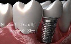 2025诺贝尔种植牙尺寸怎么选？适配哪种牙槽骨？