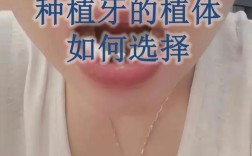 301种植牙成功率高