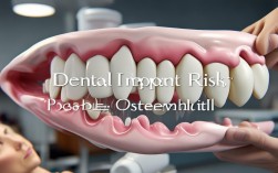 种植牙致骨髓炎？最新研究，种植牙会引发骨髓炎吗？