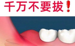 拔完智慧牙后，种牙是必须的治疗方案吗？