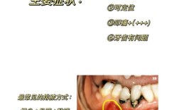 牙根周炎治疗方法有哪些？哪种方案更有效？