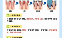 牙周炎种牙是否必须全部种植？