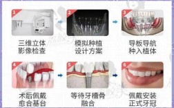 即拔即种牙的流程具体是怎样的？哪些患者适合这种治疗方式？又存在哪些潜在风险和注意事项？