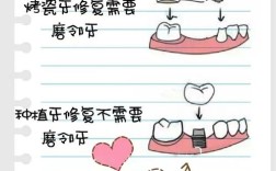 镶牙和种牙哪个更好？哪种更适合你的牙齿需求？