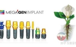 美国3i植体系统种牙效果如何？有哪些优势？适合哪些人？