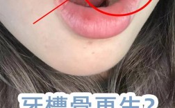 拔牙后长时间不种牙，对邻牙、牙槽骨及咬合功能有何影响？