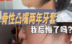 骨性值不值得正畸