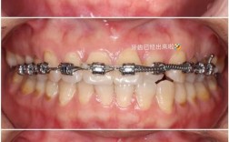 海南做牙齿矫正效果如何？价格贵不贵？哪家医院靠谱？