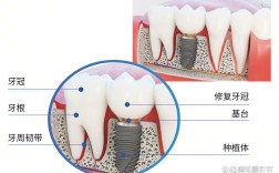 济南哪家医院种牙技术好？求靠谱推荐！