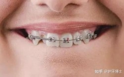 20岁正畸效果如何？这个年龄矫正会比小时候差吗？