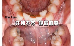 牙齿矫正有失败案例吗