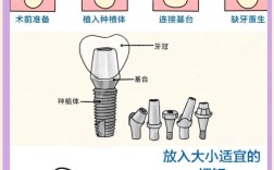 种牙后还能再次种植牙齿吗？