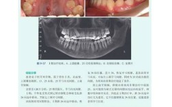 口腔正畸MBT系统书籍