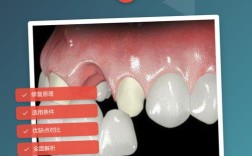 植牙和烤瓷牙，哪种更适合你的牙齿修复？
