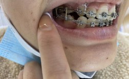 上海哪里能矫正牙齿