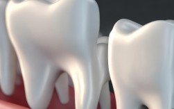 种植牙长期使用危害多？2025最新研究揭示潜在风险有哪些？