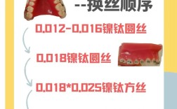 正畸弓丝自行车教程