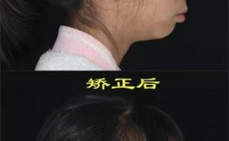 南京牙齿矫正哪家好？如何挑选靠谱机构？