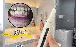 口腔超声波洁牙方法怎么做？过程安全吗？